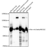 Western Blot - Anti-RVR Antibody (A305360) - Antibodies.com