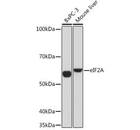 Western Blot - Anti-eIF2A Antibody [ARC1712] (A305361) - Antibodies.com