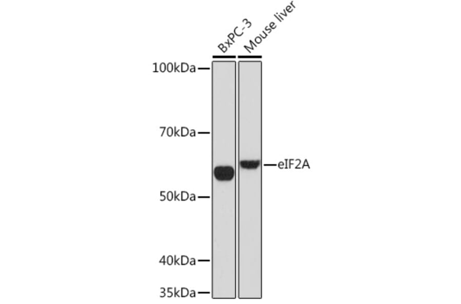 Western Blot - Anti-eIF2A Antibody [ARC1712] (A305361) - Antibodies.com