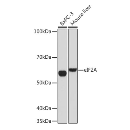 Western Blot - Anti-eIF2A Antibody [ARC1712] (A305361) - Antibodies.com