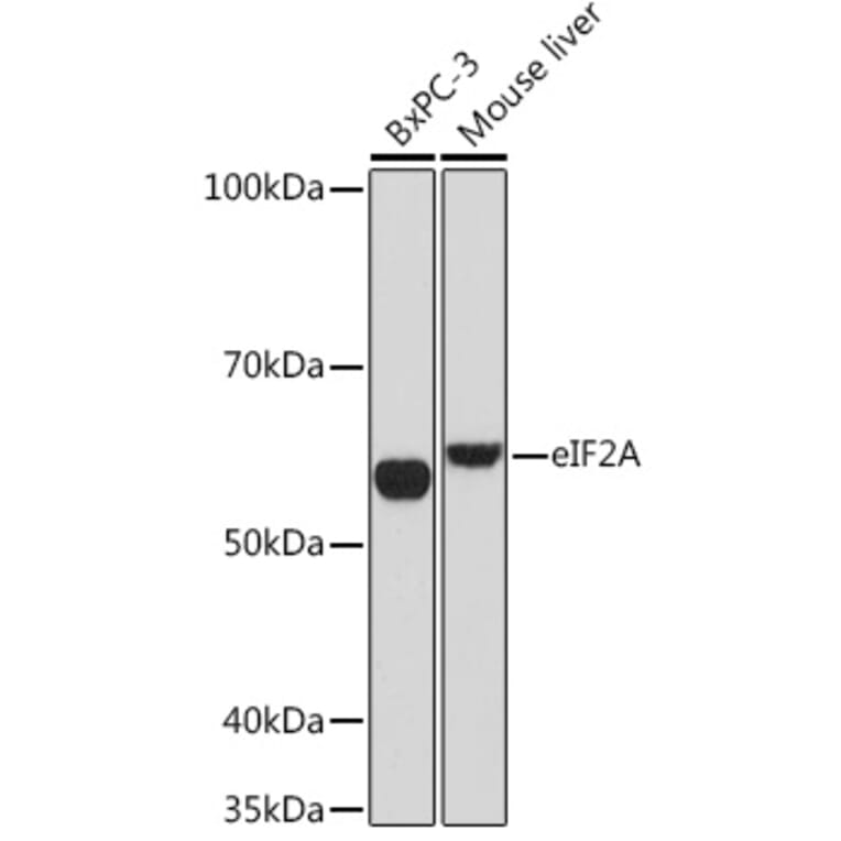 Western Blot - Anti-eIF2A Antibody [ARC1712] (A305361) - Antibodies.com