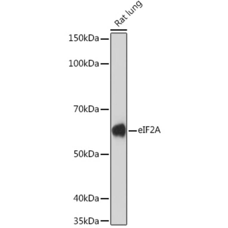 Western Blot - Anti-eIF2A Antibody [ARC1712] (A305361) - Antibodies.com