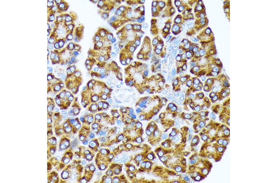 Immunohistochemistry - Anti-eIF2A Antibody [ARC1712] (A305361) - Antibodies.com