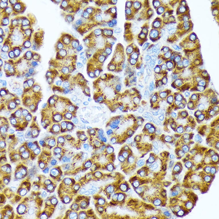 Immunohistochemistry - Anti-eIF2A Antibody [ARC1712] (A305361) - Antibodies.com