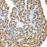 Immunohistochemistry - Anti-eIF2A Antibody [ARC1712] (A305361) - Antibodies.com