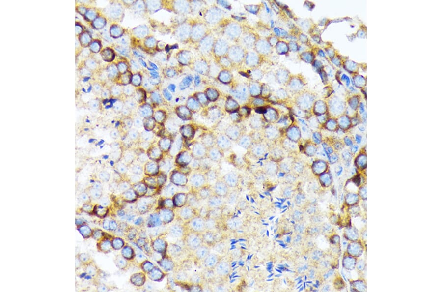 Immunohistochemistry - Anti-eIF2A Antibody [ARC1712] (A305361) - Antibodies.com