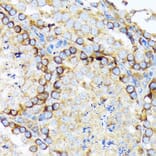 Immunohistochemistry - Anti-eIF2A Antibody [ARC1712] (A305361) - Antibodies.com