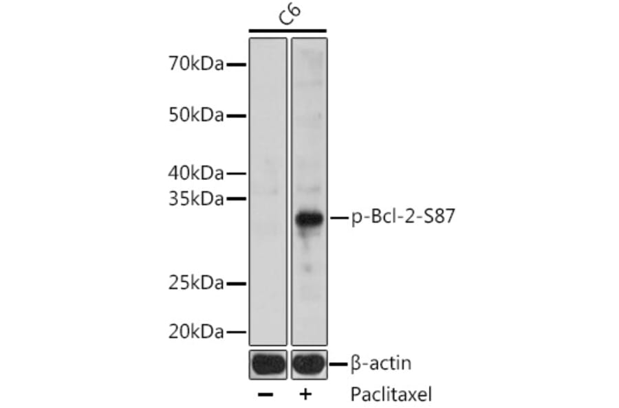 Western Blot - Anti-Bcl-2 (phospho Ser87) Antibody (A305363) - Antibodies.com