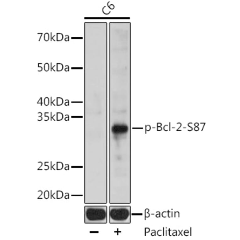 Western Blot - Anti-Bcl-2 (phospho Ser87) Antibody (A305363) - Antibodies.com