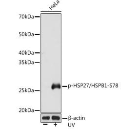 Western Blot - Anti-Hsp27 (phospho Ser78) Antibody (A305364) - Antibodies.com