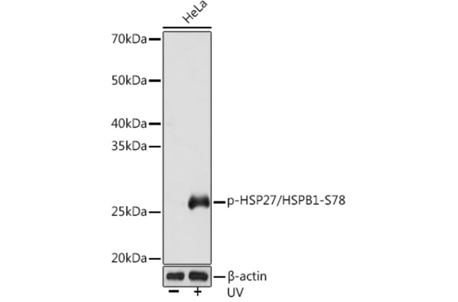 Western Blot - Anti-Hsp27 (phospho Ser78) Antibody [ARC1577] (A305364) - Antibodies.com