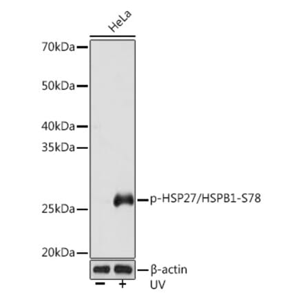 Western Blot - Anti-Hsp27 (phospho Ser78) Antibody (A305364) - Antibodies.com