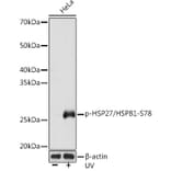 Western Blot - Anti-Hsp27 (phospho Ser78) Antibody [ARC1577] (A305364) - Antibodies.com