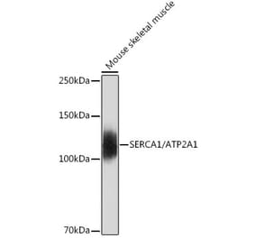 Western Blot - Anti-SERCA1 ATPase Antibody [ARC2207] (A305365) - Antibodies.com