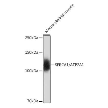 Western Blot - Anti-SERCA1 ATPase Antibody [ARC2207] (A305365) - Antibodies.com