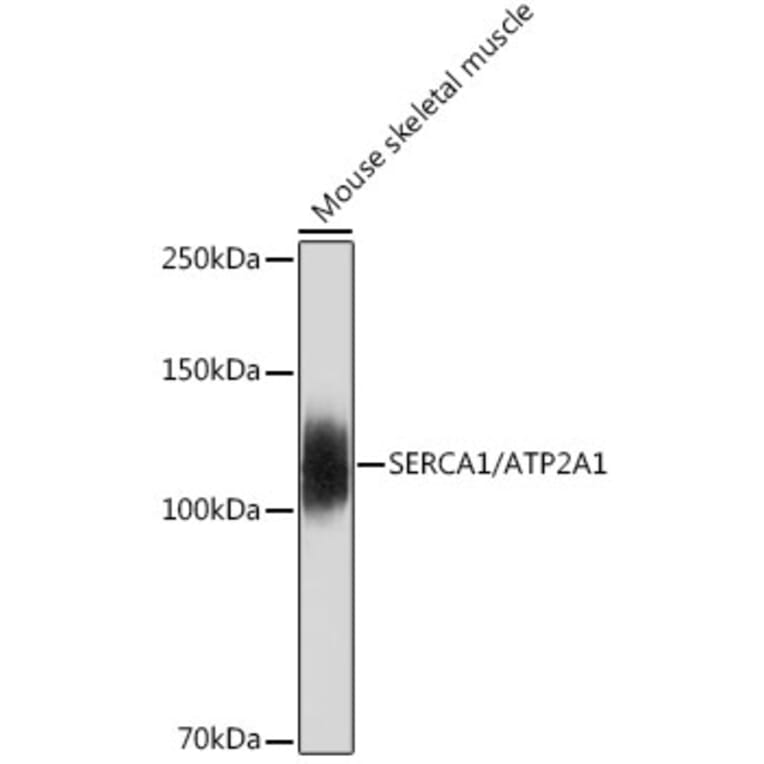 Western Blot - Anti-SERCA1 ATPase Antibody [ARC2207] (A305365) - Antibodies.com