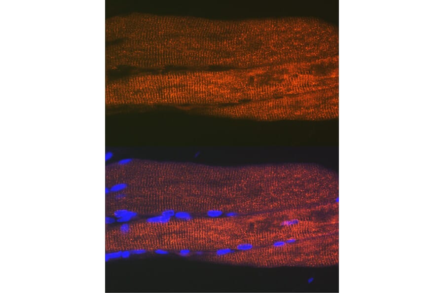 Immunofluorescence - Anti-SERCA1 ATPase Antibody [ARC2207] (A305365) - Antibodies.com