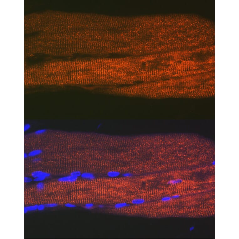 Immunofluorescence - Anti-SERCA1 ATPase Antibody [ARC2207] (A305365) - Antibodies.com