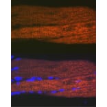 Immunofluorescence - Anti-SERCA1 ATPase Antibody [ARC2207] (A305365) - Antibodies.com