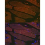 Immunofluorescence - Anti-SERCA1 ATPase Antibody [ARC2207] (A305365) - Antibodies.com