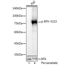 Western Blot - Anti-BTK (phospho Tyr223) Antibody [ARC0307] (A305366) - Antibodies.com