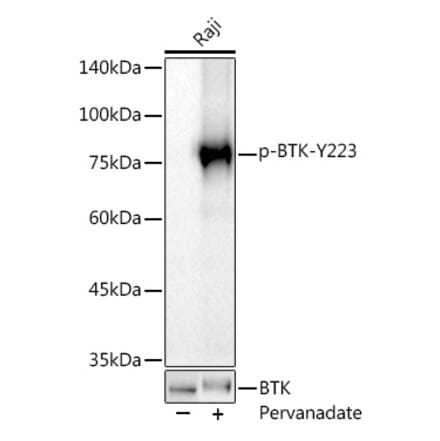 Western Blot - Anti-BTK (phospho Tyr223) Antibody [ARC0307] (A305366) - Antibodies.com
