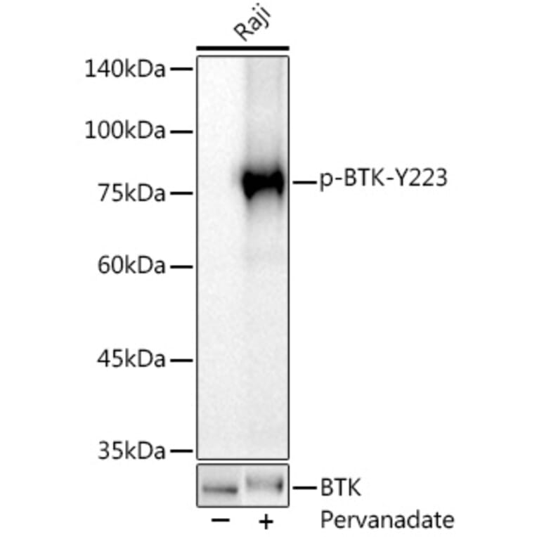 Western Blot - Anti-BTK (phospho Tyr223) Antibody [ARC0307] (A305366) - Antibodies.com