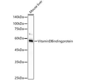 Western Blot - Anti-Vitamin D Binding protein Antibody [ARC53914] (A305367) - Antibodies.com