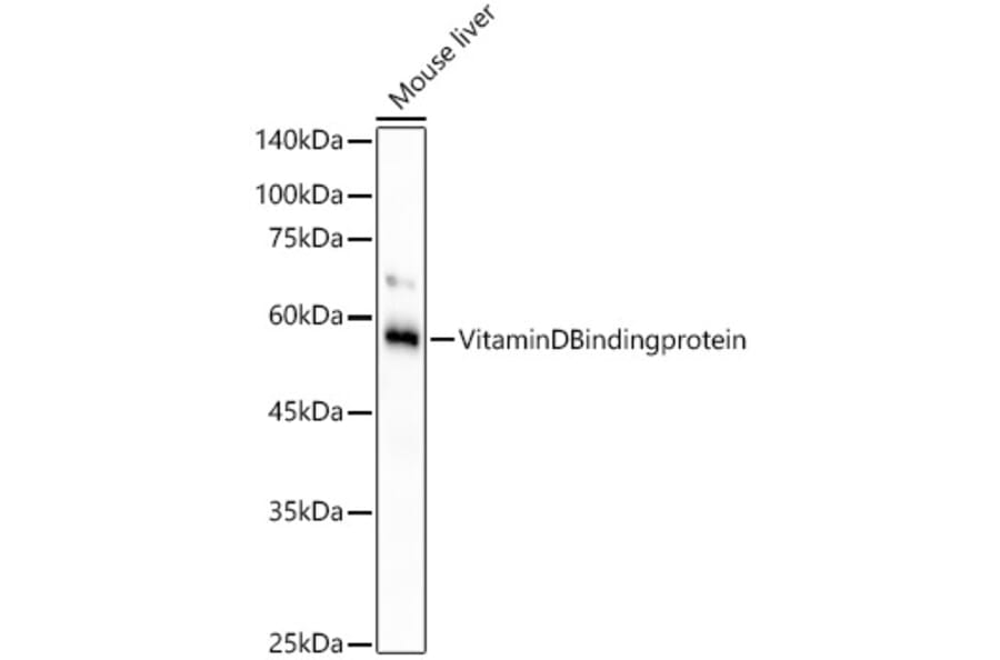 Western Blot - Anti-Vitamin D Binding protein Antibody [ARC53914] (A305367) - Antibodies.com