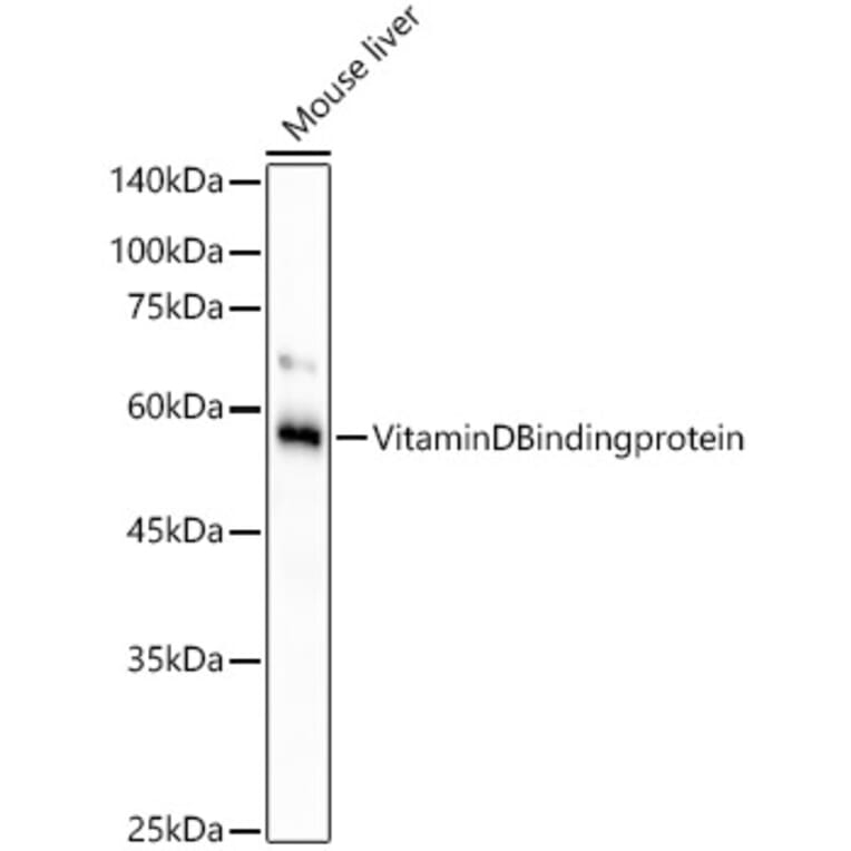 Western Blot - Anti-Vitamin D Binding protein Antibody [ARC53914] (A305367) - Antibodies.com