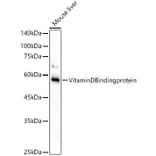 Western Blot - Anti-Vitamin D Binding protein Antibody [ARC53914] (A305367) - Antibodies.com