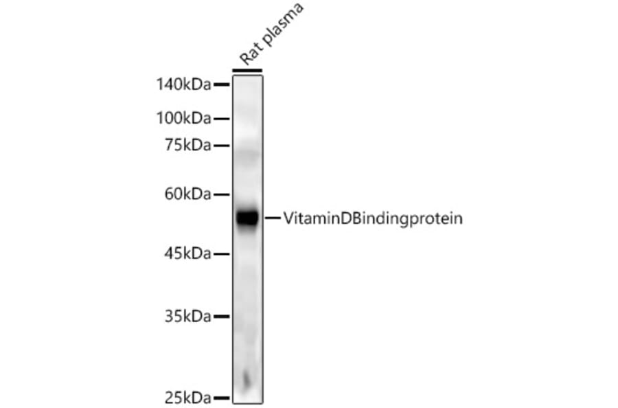 Western Blot - Anti-Vitamin D Binding protein Antibody [ARC53914] (A305367) - Antibodies.com