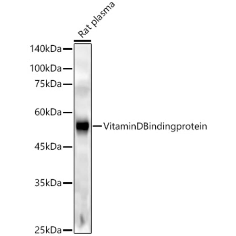 Western Blot - Anti-Vitamin D Binding protein Antibody [ARC53914] (A305367) - Antibodies.com