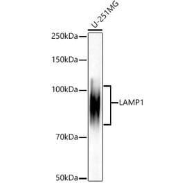 Western Blot - Anti-LAMP1 Antibody [ARC52154] (A305368) - Antibodies.com