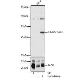 Western Blot - Anti-FADD (phospho Ser194) Antibody (A305369) - Antibodies.com
