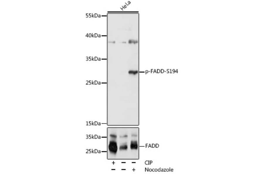 Western Blot - Anti-FADD (phospho Ser194) Antibody (A305369) - Antibodies.com