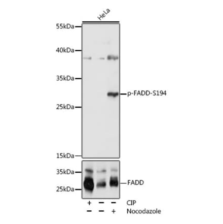 Western Blot - Anti-FADD (phospho Ser194) Antibody (A305369) - Antibodies.com