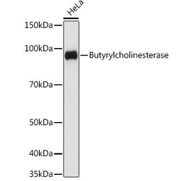 Western Blot - Anti-Butyrylcholinesterase Antibody [ARC1328] (A305370) - Antibodies.com