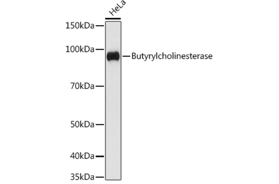 Western Blot - Anti-Butyrylcholinesterase Antibody [ARC1328] (A305370) - Antibodies.com