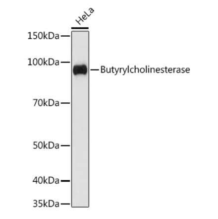 Western Blot - Anti-Butyrylcholinesterase Antibody [ARC1328] (A305370) - Antibodies.com