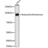 Western Blot - Anti-Butyrylcholinesterase Antibody [ARC1328] (A305370) - Antibodies.com