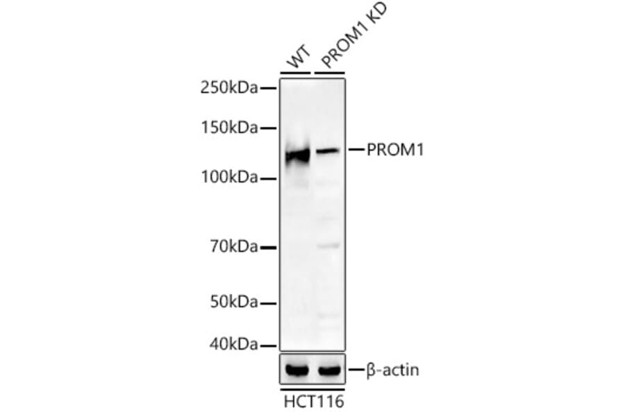 Western Blot - Anti-CD133 Antibody (A305371) - Antibodies.com