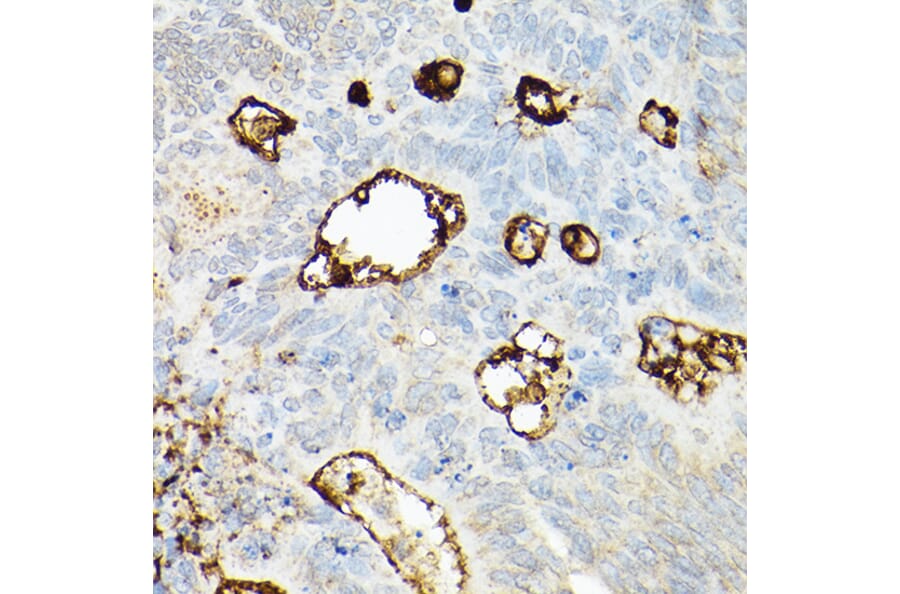 Immunohistochemistry - Anti-CD133 Antibody (A305371) - Antibodies.com