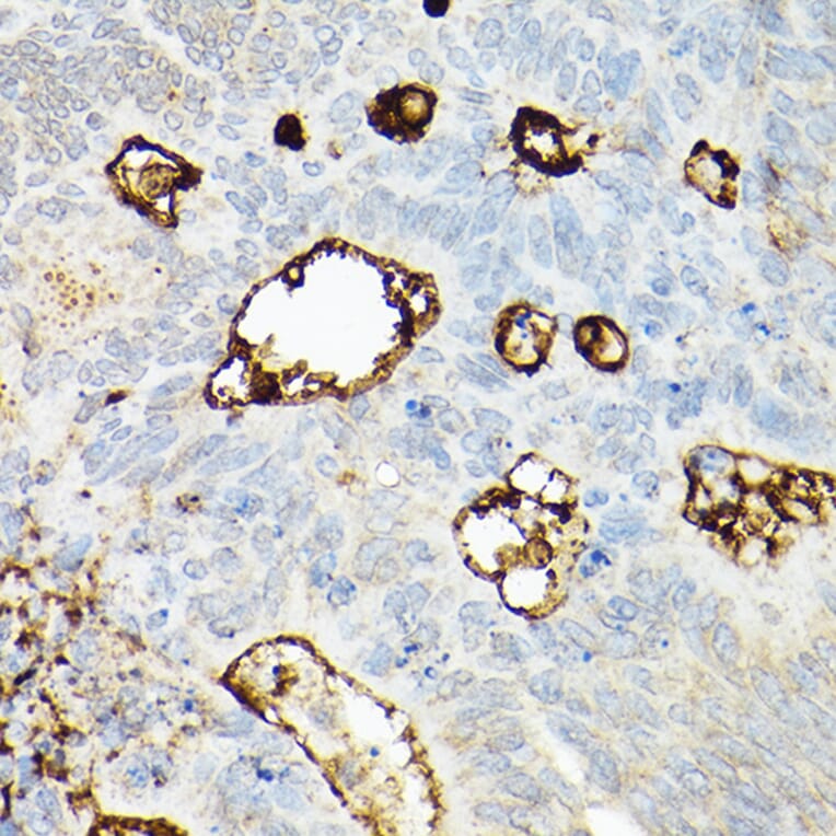 Immunohistochemistry - Anti-CD133 Antibody (A305371) - Antibodies.com