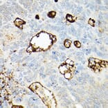 Immunohistochemistry - Anti-CD133 Antibody (A305371) - Antibodies.com