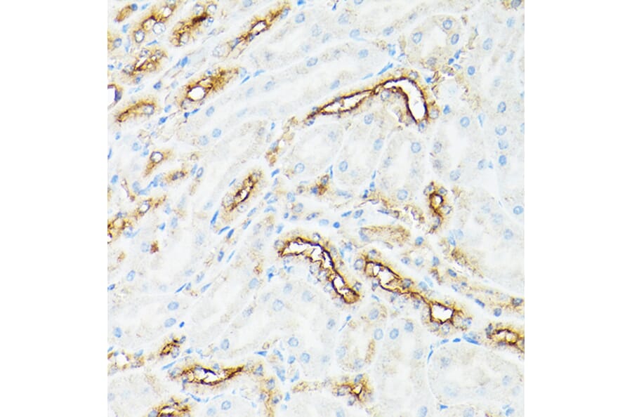 Immunohistochemistry - Anti-CD133 Antibody (A305371) - Antibodies.com