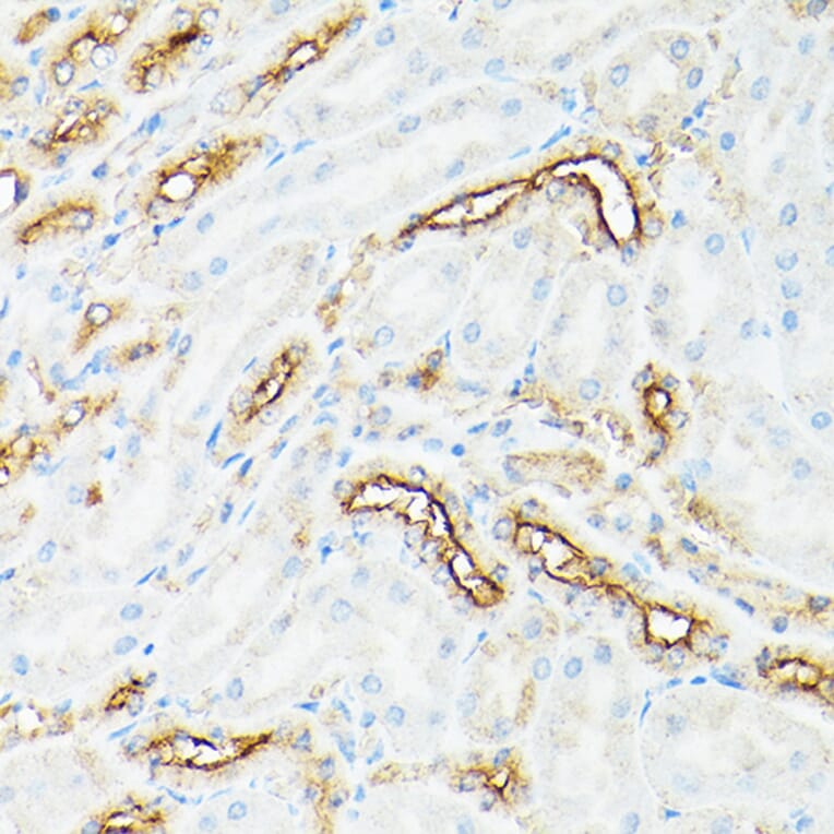 Immunohistochemistry - Anti-CD133 Antibody (A305371) - Antibodies.com