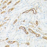 Immunohistochemistry - Anti-CD133 Antibody (A305371) - Antibodies.com