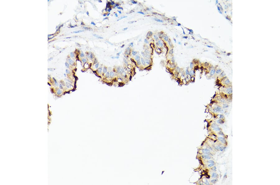 Immunohistochemistry - Anti-CD133 Antibody (A305371) - Antibodies.com