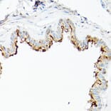 Immunohistochemistry - Anti-CD133 Antibody (A305371) - Antibodies.com